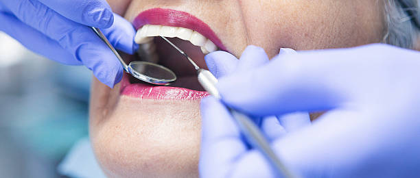 Best Broken or Cracked Tooth Emergency Dentist in Beardstown, IL